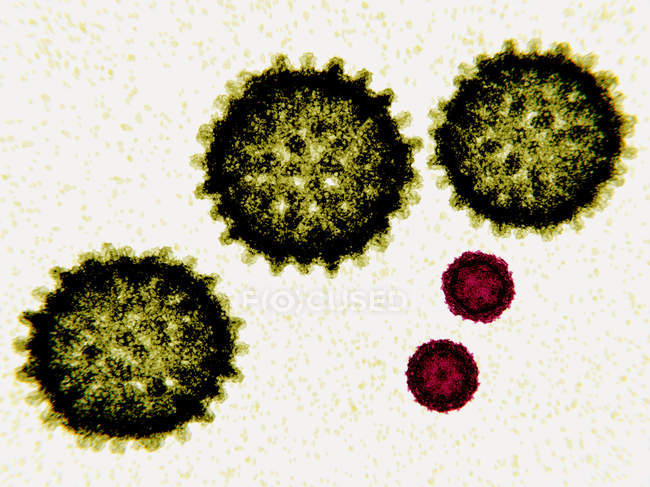 Partículas do vírus da hepatite C e da pólio, ilustração digital . — Fotografia de Stock