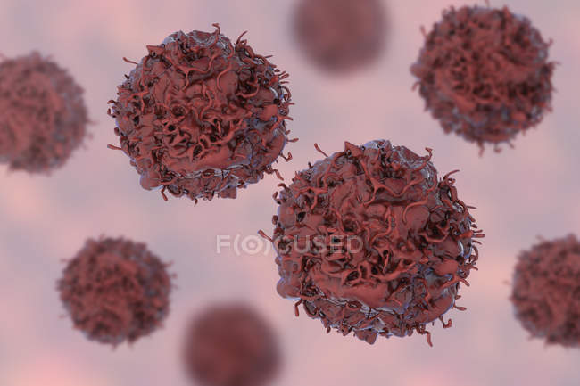 Células cancerosas pulmonares, ilustración digital
. - foto de stock