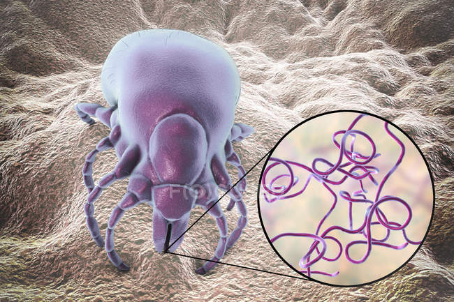 Lyme-Borreliose Zecke und Nahaufnahme von Borrelia burgdorferi Bakterien, digitale Illustration. — Stockfoto