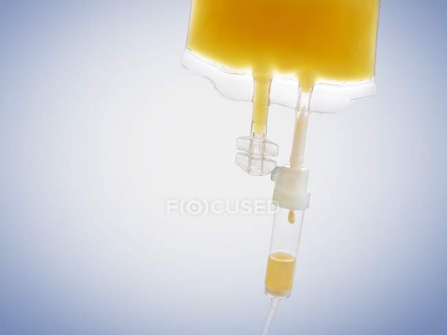 IV мішок з апельсиновим соком, студійний знімок . — стокове фото