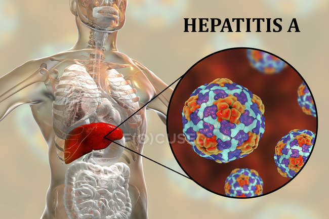 Illustration numérique de silhouette avec inflammation du foie et gros plan du virus de l'hépatite A
. — Photo de stock