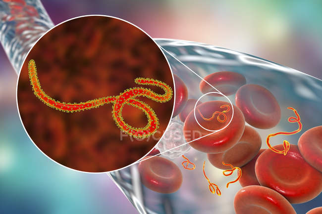 Ebola-Virus im Blut und Nahaufnahme von Virionen, digitale Illustration. — Stockfoto