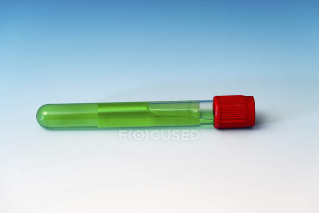 Крупним планом зелений хімічний зразок у скляній фіалі . — стокове фото