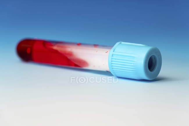 Primer plano de la muestra de sangre en la ampolla de vidrio . - foto de stock
