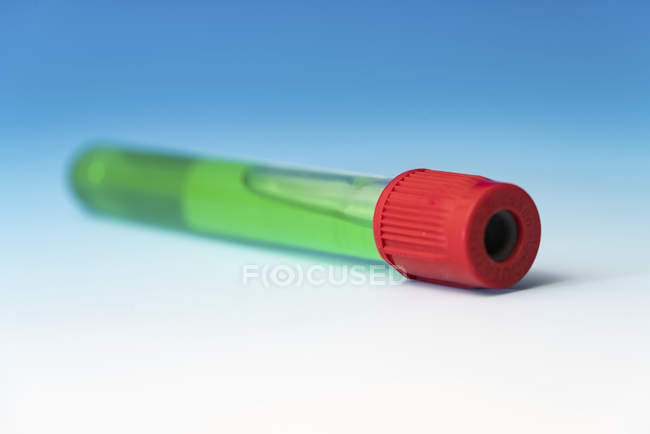 Gros plan d'un échantillon chimique vert dans une fiole de verre . — Photo de stock