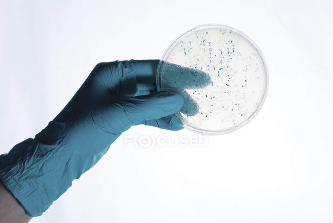 Scientist hand carrying bacteria colonies growing in Petri dish. — Stock Photo