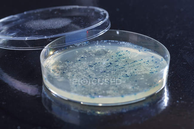 Close-up of bacteria colonies growing in Petri dish. — Stock Photo