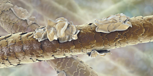 Digital illustration of human hair with dandruff. — Stock Photo