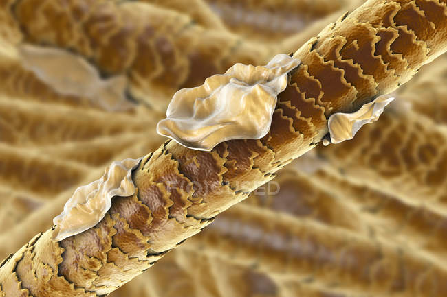 Цифровая иллюстрация человеческих волос с перхоти . — стоковое фото