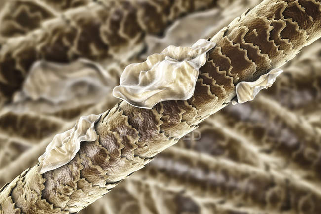 Цифровая иллюстрация человеческих волос с перхоти . — стоковое фото