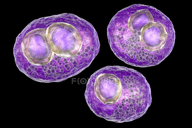 Digital artwork of human cells with cytomegalic inclusion disease symptom of cytomegalovirus infection. — Stock Photo