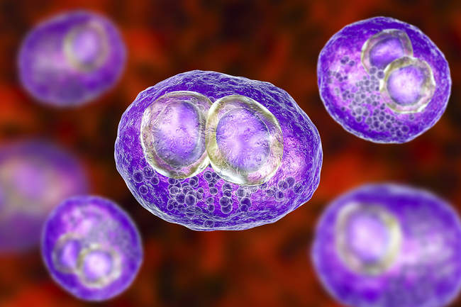 Arte digital de células humanas con enfermedad por inclusión citomegálica síntoma de infección por citomegalovirus . - foto de stock