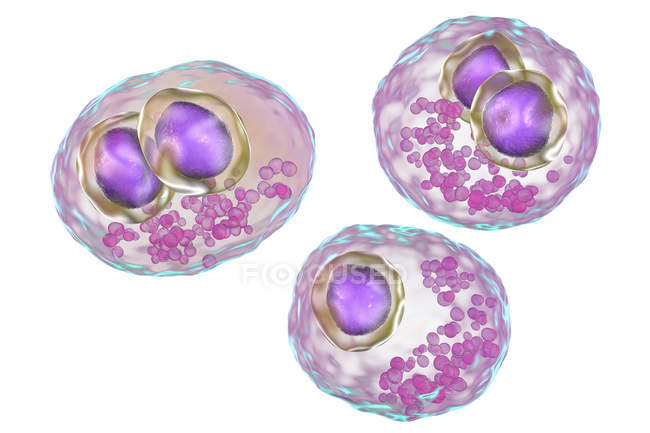 Цифрове мистецтво людських клітин із симптом цитомегаловірусної інфекції . — стокове фото