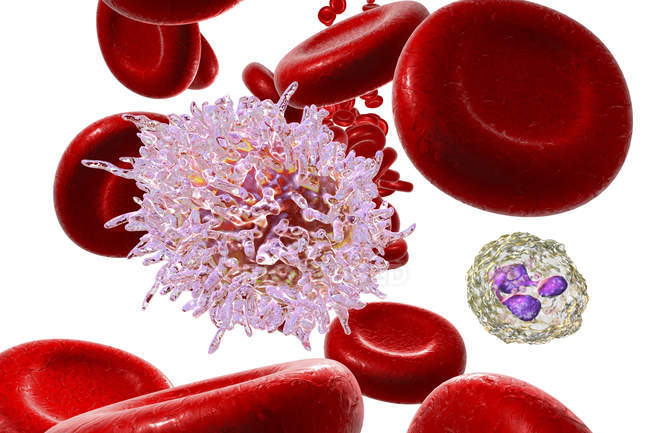 Digital illustration of abnormal blood cells infected by hairy cell leukemia. — Stock Photo