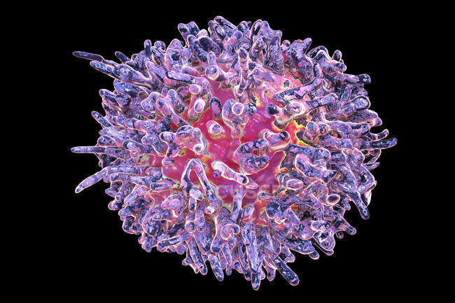 Illustrazione digitale di cellule non comuni di leucemia a cellule pelose . — Foto stock