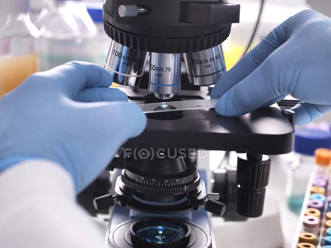 Gros plan des mains d'un scientifique plaçant une lame avec un échantillon humain au microscope photonique pour des tests médicaux
. — Photo de stock