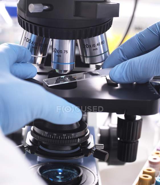 Close-up of hands of scientist placing slide with human sample under light microscope for medical testing. — Stock Photo