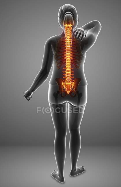 Silhueta feminina com dor nas costas, ilustração digital. — Fotografia de Stock