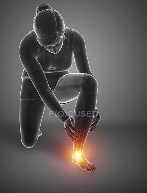 Bending female silhouette with foot pain, digital illustration. — Stock Photo
