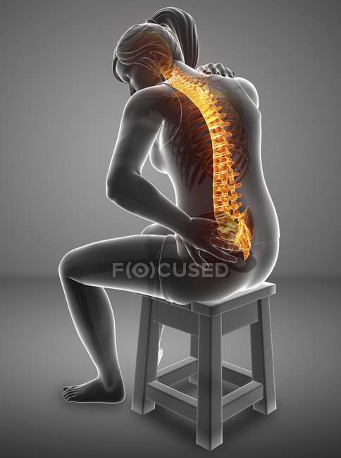 Sentado en el taburete silueta femenina con dolor de espalda, ilustración digital . - foto de stock