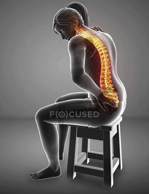 Sentado en el taburete silueta femenina con dolor de espalda, ilustración digital . - foto de stock