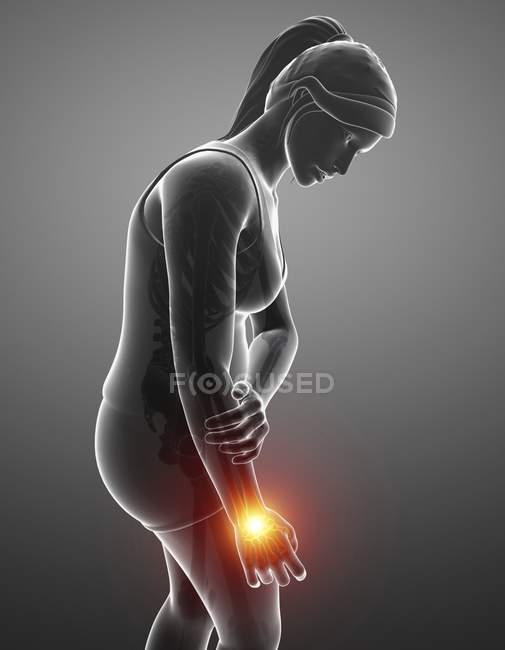 Женский силуэт с болью в запястье, цифровая иллюстрация . — стоковое фото