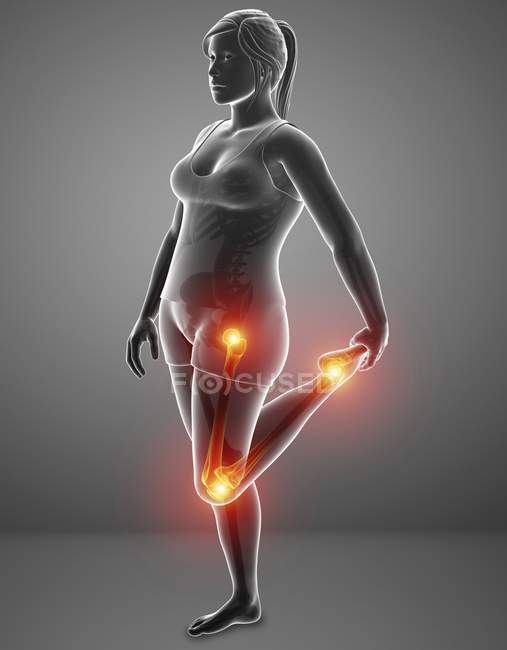 Silhueta feminina com dor nas pernas, ilustração digital . — Fotografia de Stock