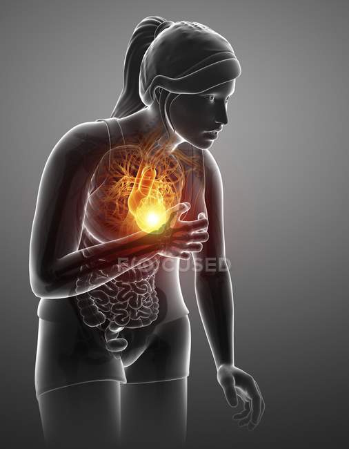 Female silhouette with chest pain, digital illustration. — Stock Photo