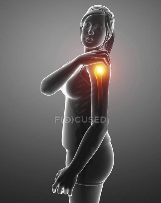 Silhouette féminine avec épaule douloureuse, illustration numérique . — Photo de stock