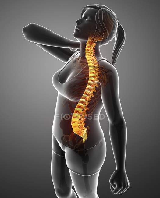 Жіночий силует з болем у спині, цифровий приклад. — стокове фото