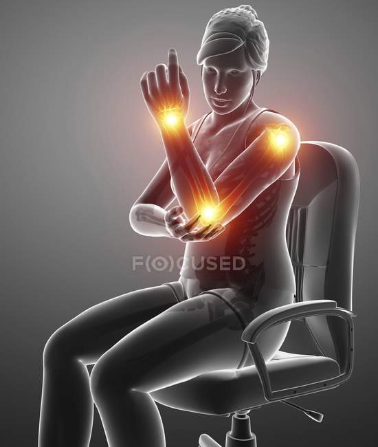 Сидячи в кріслі жіночий силует з болем в руці, цифрова ілюстрація . — стокове фото
