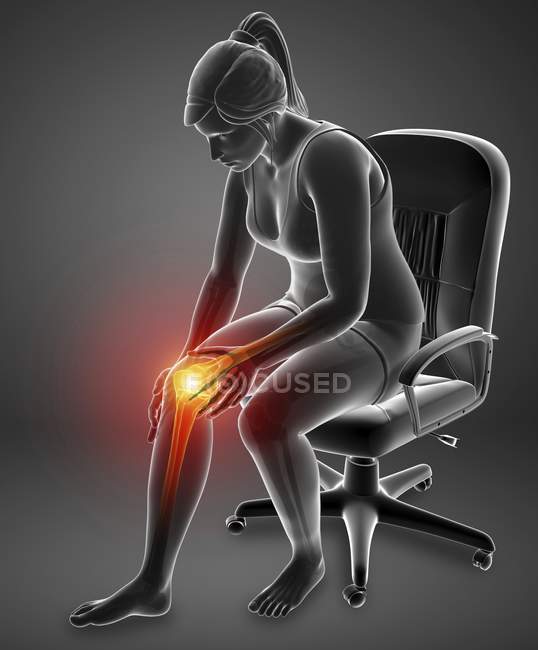 Sitting in chair female silhouette with knee pain, digital illustration. — Stock Photo