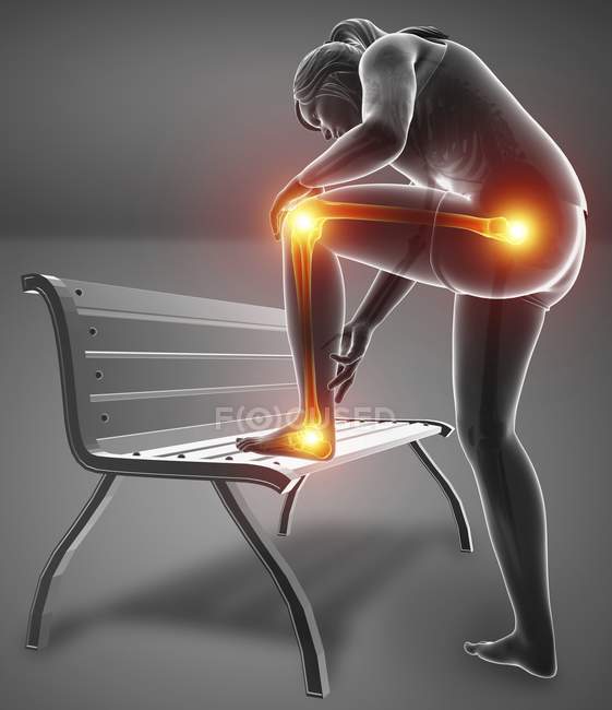 Apoyado en el banco silueta femenina con dolor en las piernas, ilustración digital . - foto de stock