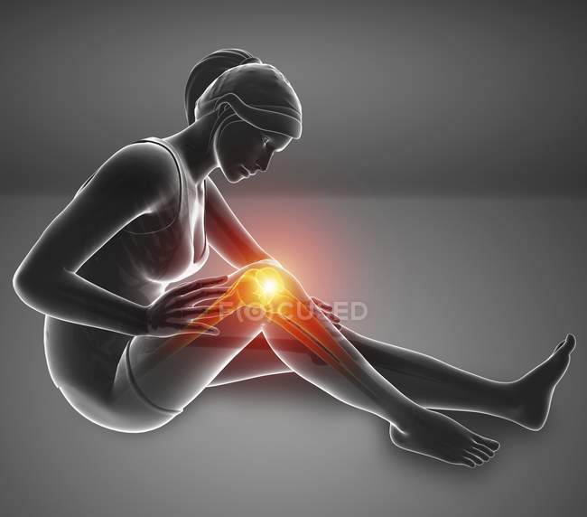 Sitting female silhouette with knee pain, digital illustration. — Stock Photo