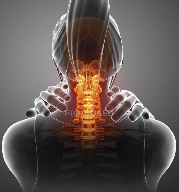 Silhueta feminina com dor no pescoço, ilustração digital . — Fotografia de Stock