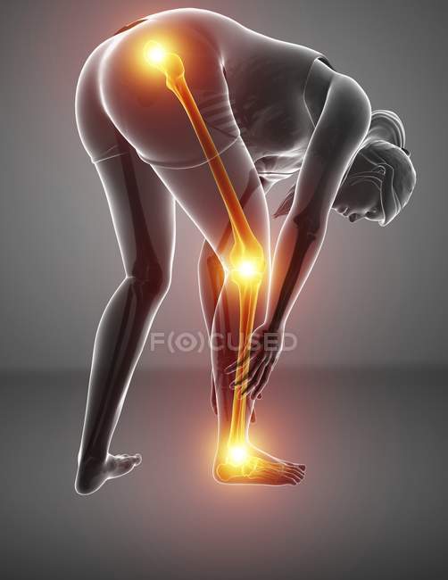 Silhouette féminine cintrée avec douleur aux jambes, illustration numérique
. — Photo de stock