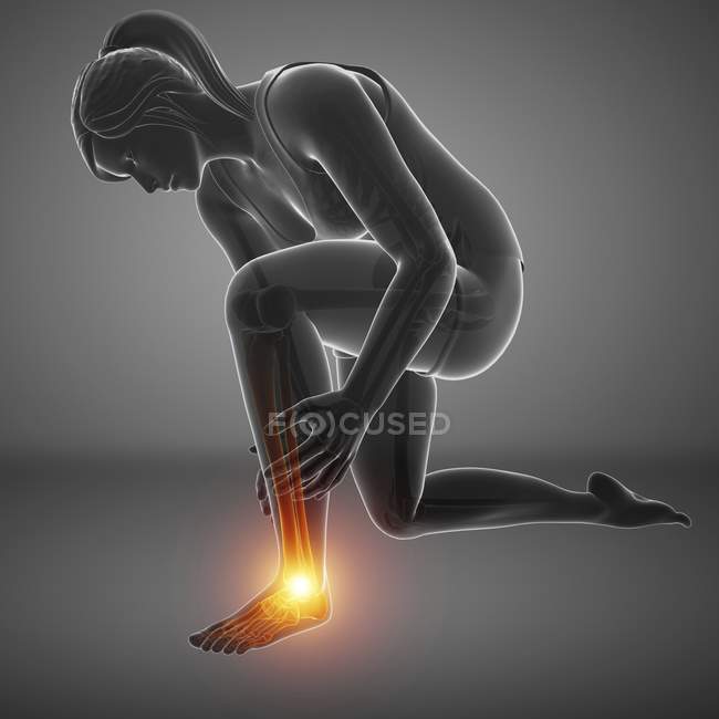 Flessione silhouette femminile con dolore ai piedi, illustrazione digitale . — Foto stock