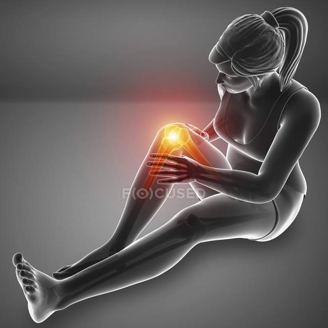 Silhouette féminine assise avec douleur au genou, illustration numérique . — Photo de stock