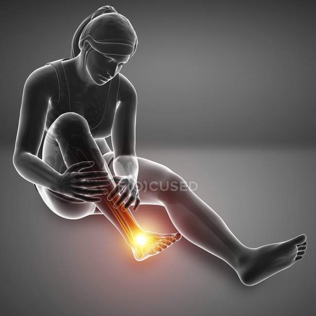 Sentado silueta femenina con dolor en el pie, ilustración digital . - foto de stock