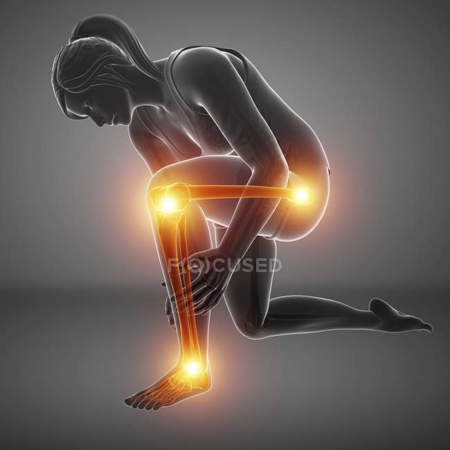 Flexión silueta femenina con dolor en las piernas, ilustración digital . - foto de stock