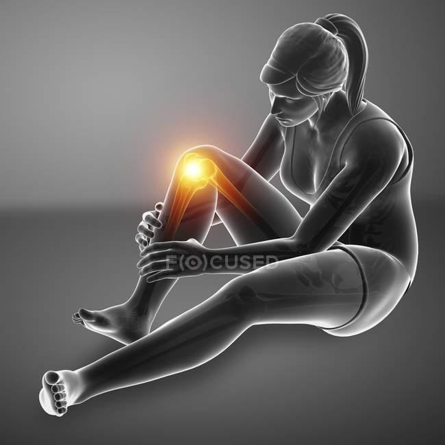 Сидячи жіночий силует з коліном біль, цифрова ілюстрація. — стокове фото