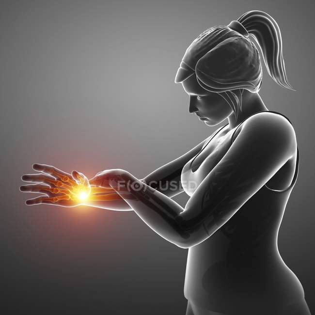 Женский силуэт с болью в запястье, цифровая иллюстрация . — стоковое фото