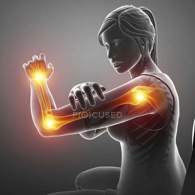 Женский силуэт с болью в руке, цифровая иллюстрация
. — стоковое фото
