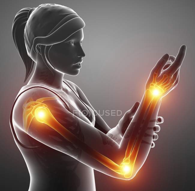Женский силуэт с болью в руке, цифровая иллюстрация . — стоковое фото