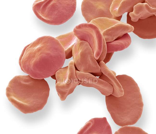 Colored scanning electron micrograph of red blood cells. — Stock Photo