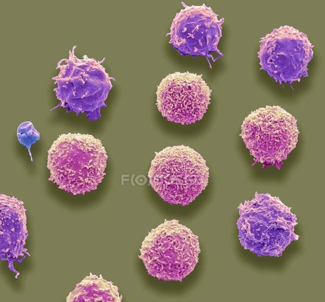 Colored scanning electron micrograph of white blood cells and single platelet. — Stock Photo