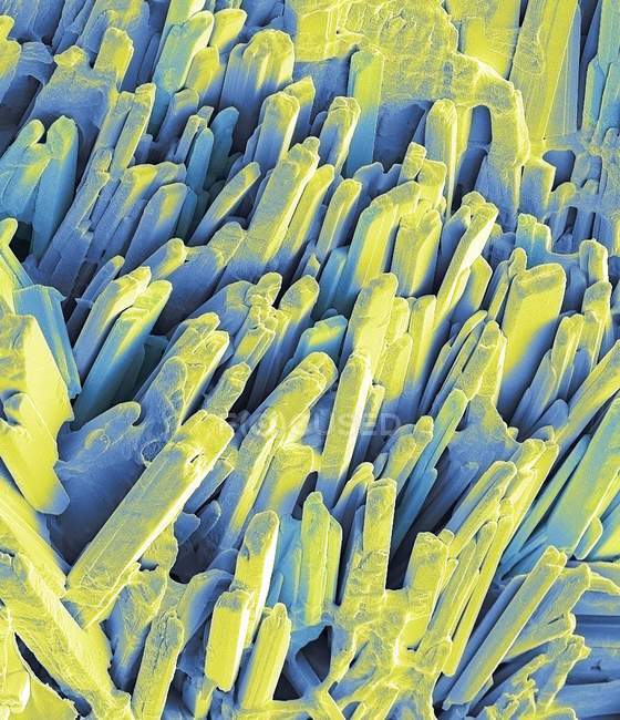Micrografía electrónica de barrido de color abstracto de superficie cristalina de cálculos biliares fracturados
. - foto de stock