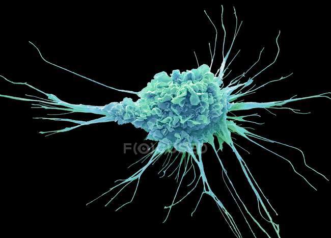 Colored scanning electron micrograph of protective dendritic cell of immune system. — Stock Photo