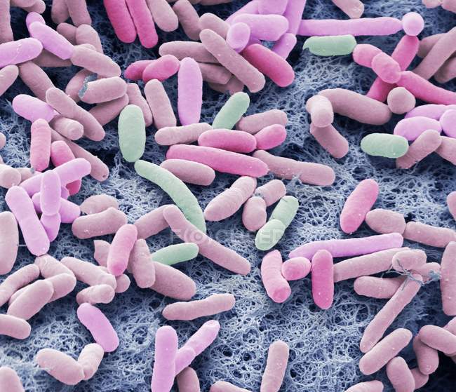 Micrographie électronique à balayage coloré de bactéries Gram négatives en forme de tige Escherichia coli
. — Photo de stock