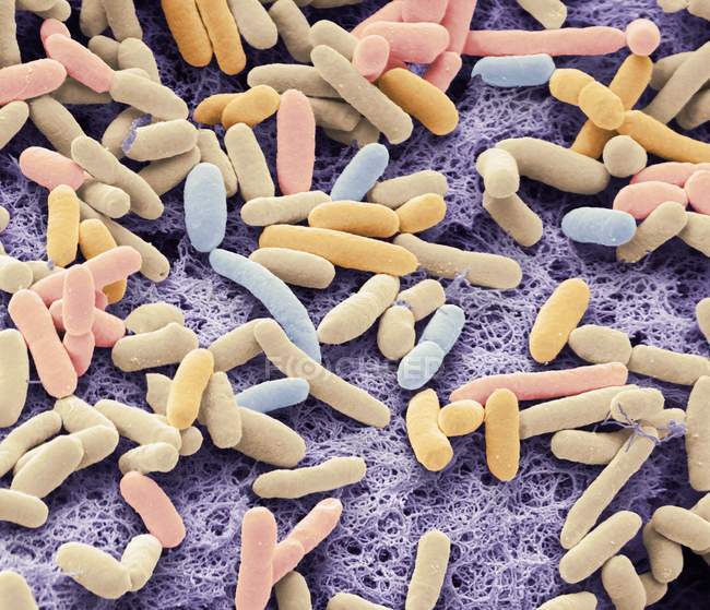 Micrographie électronique à balayage coloré de bactéries Gram négatives en forme de tige Escherichia coli . — Photo de stock